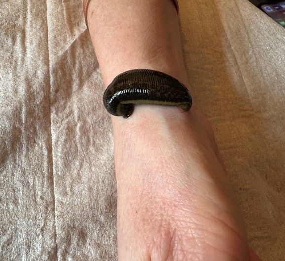 Behandlung: Blutegel auf einem Unterarm. Bild von Heilpraktikerin Sandra Strese