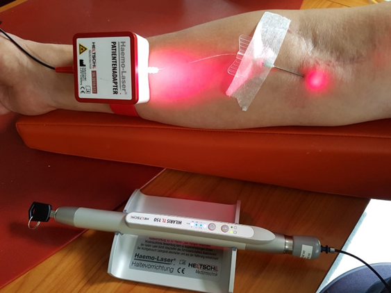 Intravenöse Lasertherapie am Unterarm mit rotem Haemo-Laser und eingestochener Kanüle - Anwendung zur biologischen Regulation und Durchblutungsförderung